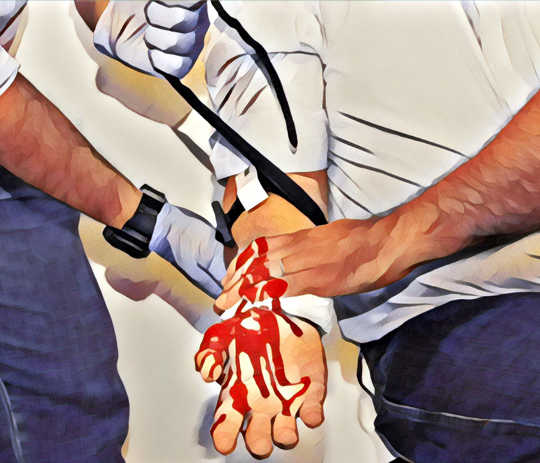 stop the bleed